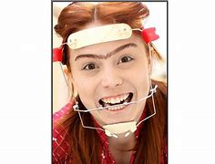 Image result for Orthodontic Headgear