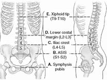 Image result for Lumbar Spine Anatomical Landmarks