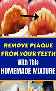 Image result for How to Avoid Plaque On Teeth