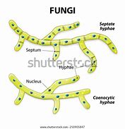 Image result for Fungi without Hyphae