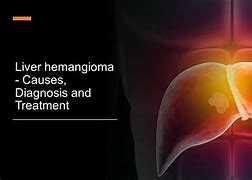 Image result for Hemangioma On Liver