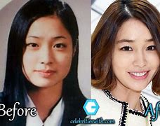 Image result for Lee Min Ki Plastic Surgery