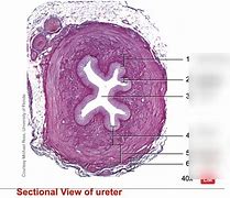 Image result for Ureter Histology Slides Labeled