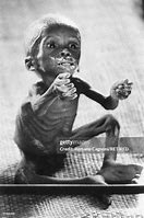 Image result for Starving Babies in Africa