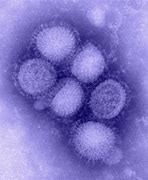 Image result for Influenza Virus Picture