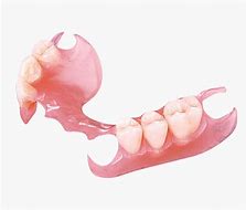 Image result for Valplast Partial One Tooth