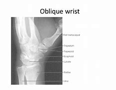 Image result for PA Oblique Lateral Rotation Knee