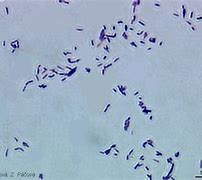 Image result for Mycobacterium GM's Stain