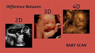 Image result for Baby Scan 3D 4D