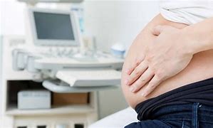 Image result for Cephalic Birth Defects