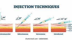 Image result for Subcutaneous Injection