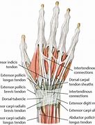 Image result for Common Extensor Tendon Anatomy