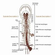 Image result for Relations of Esophagus