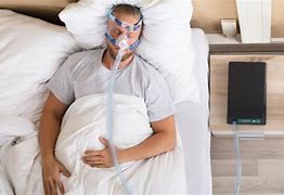 Image result for Sleep Apnea Treatment