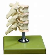 Image result for Dorsal Vertebrae