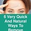 Image result for How to Remove Wrinkles around Mouth