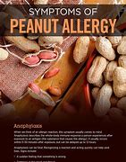 Image result for Peanut Butter Allergy