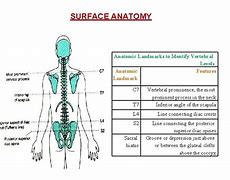 Image result for Lumbar Spine Anatomical Landmarks