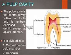 Image result for Pulp Anatomy