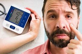 Image result for High Blood Pressure Red Face