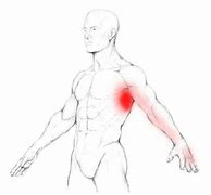 Image result for Serratus Anterior Muscle Referred Pain