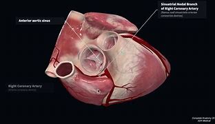 Image result for Atrioventricular Nodal Artery