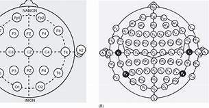 Image result for tDCS Placement Map