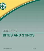 Image result for Bites and Stings Nursing PPT