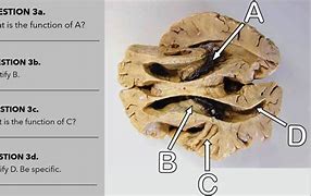 Image result for Dorsal Spine View