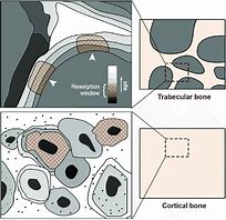 Image result for Bone Cells in Pores