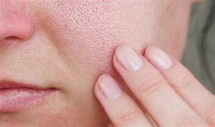 Image result for Macro Skin Pores