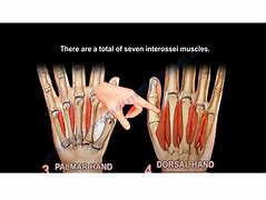 Image result for Interosseous Ligament