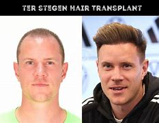 Image result for Marc-Andre Ter Stegen Long Hair