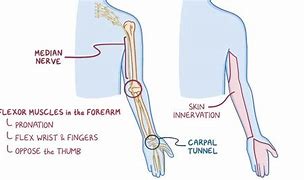 Image result for Median Nerve Distribution Arm