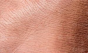 Image result for Pig Skin Conditions