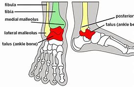 Image result for Anterior Lateral Malleolus Plumb Line