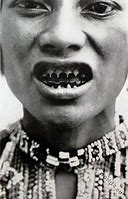 Image result for Pepega Teeth