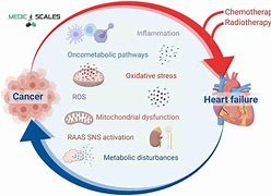 Image result for Heart Cancer Symptoms