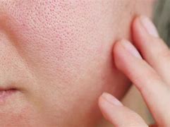 Image result for Skin Pores Up Vlose