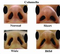 Image result for Columella Septum