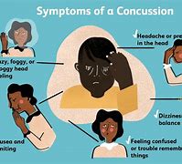 Image result for Fencing Posture Concussion