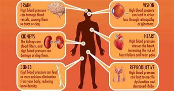 Image result for High Blood Pressure Risk Chart