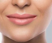 Image result for Upper Lip Wrinkles