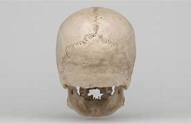 Image result for Real Human Skull 3D Scan