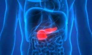 Image result for Pancreatic Cancer