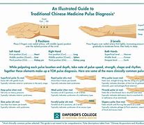 Image result for Pedal Pulse Doppler