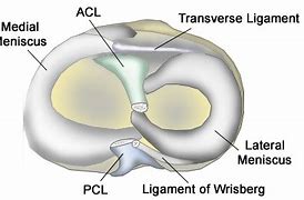 Image result for Right Knee Meniscus