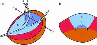 Image result for Prostate Gland Lobes