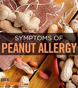 Image result for Peanut Butter Allergy Rash