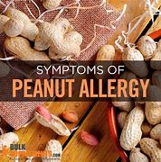 Image result for Peanut Butter Allergy